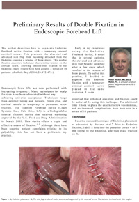 Preliminary Results of Double Fixation in Endoscopic Forehead Lift
