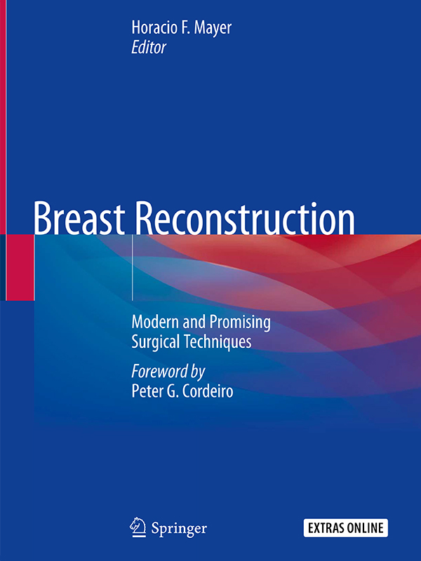 Breast Reconstruction with Adjustable Implants